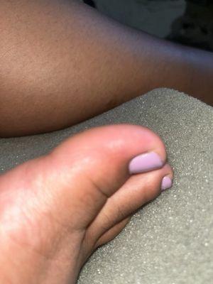 My toe is infected/inflamed after getting a pedicure here the day after.