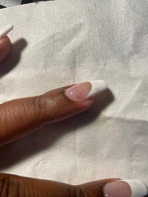 The cut that is cover with nail glue