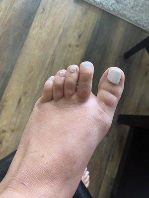 Gel toe nails