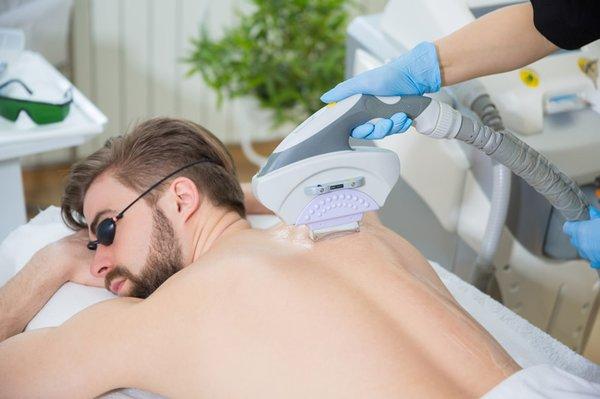 Laser Hair Removal For Men. Everyone asks if it is permanent. Yes, it is totally permanent.