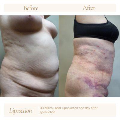 Jenesis Lipoplasty & Laser Center