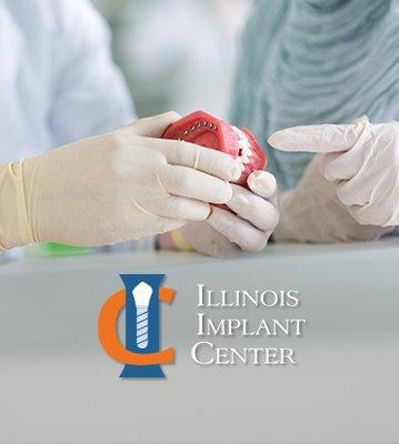 Illinois Implant Center