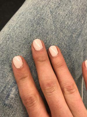 Bad gel manicure. The polish was a mess on every finger.