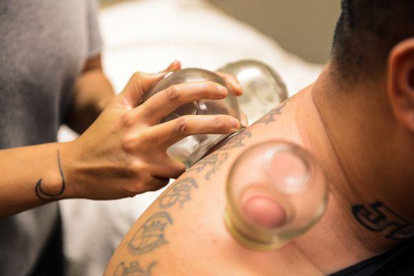 Cupping is an awesome treatment that is included in any TWC membership.