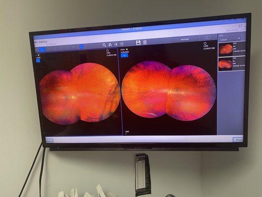 This is a photo of my retina and blood vessels - first time I have ever seen this!