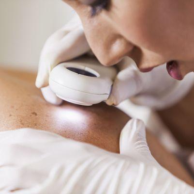 Skin Cancer Screening