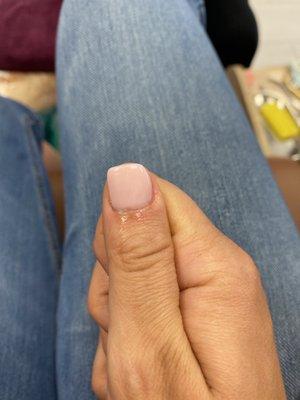 My "crooked" nail