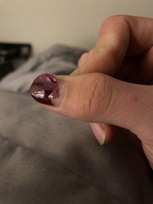 Weird peeling gel manicure after 3 days