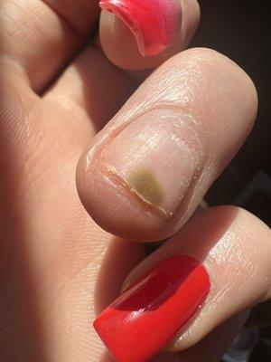 Been coming here for a long time until I got a fungus on my nail