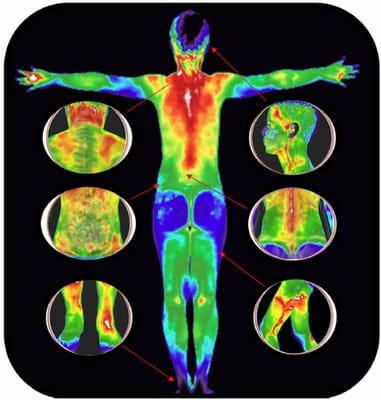 Thermographic imaging is available at Roman's! This health discovery tool is used to detect inflammation and abnormal body functions