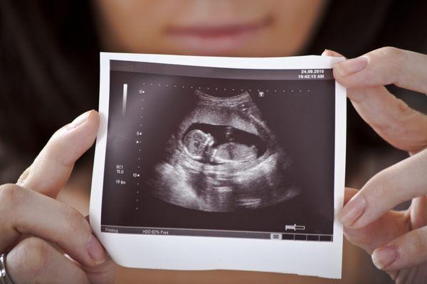 8 Week DNA Testing Gender or 13 Week Gender Reveal Ultrasounds. See your baby today and start planning for a boy or girl