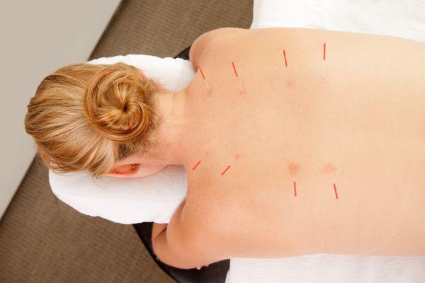 Family Acupuncture Clinic