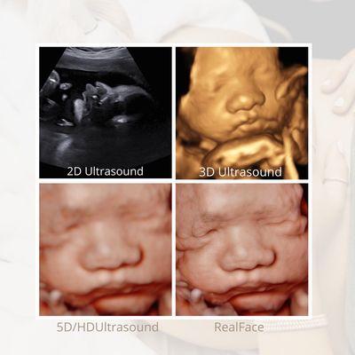 All ultrasound details