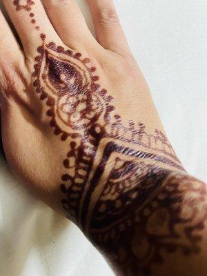 Wrinkled area is all burnt due to heena