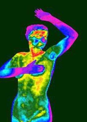 Radiation-Free Breast Thermography is Available by Appointment