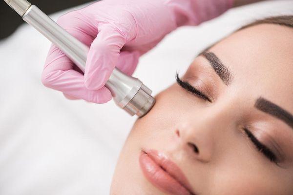 Microdermabrasion