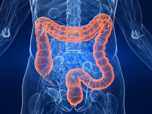 Appendectomy, GERD, Gallbladder, Diverticulitis, Colorectal Cancer