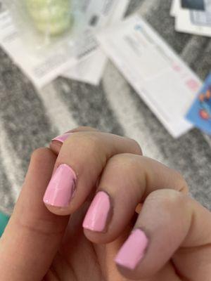 Bad manicure