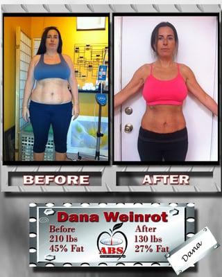 Dana Lost 80 lbs in just over 60 days on our program. She looks fantastic!