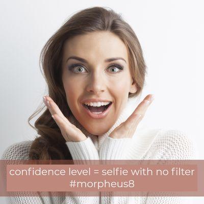 Confidence level = Selfie with no filter  #Morpheus8  Call or text 9513191730