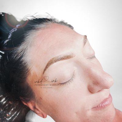 Fusion Brow Correction