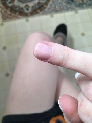 Gel nail peeled off after 3 days and took layers with it