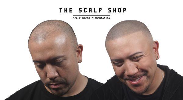 Chad's Scalp Micropigmentation results. Men's hair loss hair tattoo.