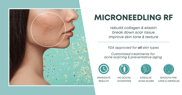 Microneedling RF