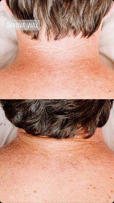 Upper Back Wax