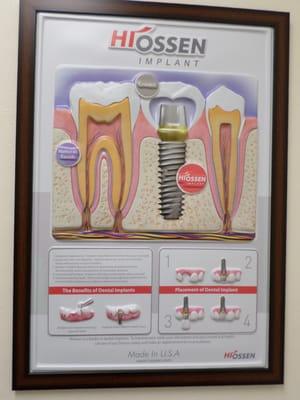 Yes, we do dental implants.