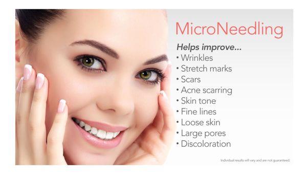 benifit of micro needling treatment