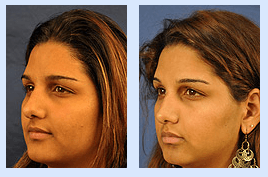 Florida Ear Nose Throat & Facial Plastic Surgery