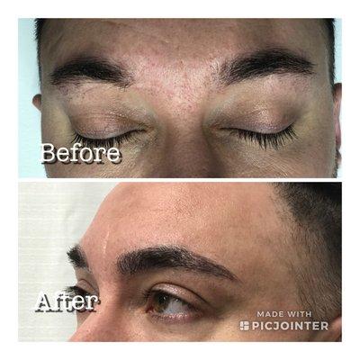 Microblading