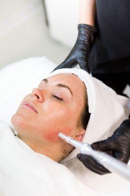 HydraFacials in Draper, Utah