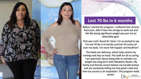 Rosie felt that losing significant weight was an unobtainable goal...until she found Dr. Vaziri!