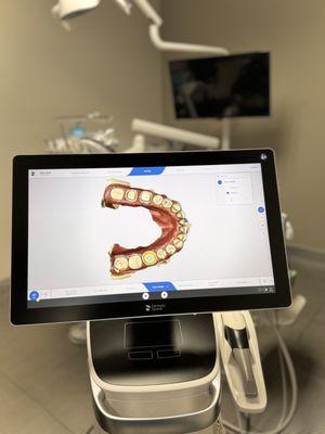 Intra-oral scanner for same-day crowns, bridges, implant crowns, night guards, retainers.