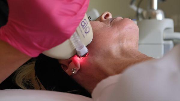 HALO Laser Treatment