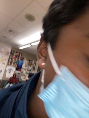 Ear infection