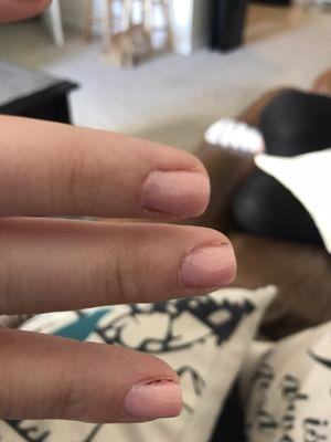 Not only is nail polish all over my fingers, but my last manicure was not fully removed and can be seen through my pointer finger