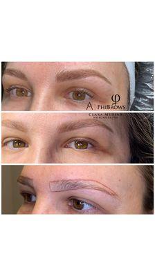 Combination brow before/after/healed