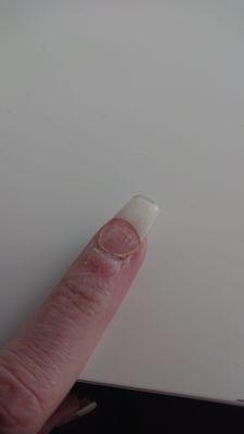 This is another nail lifting from the cuticle.