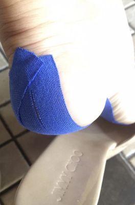 My first cortisone shot for my heel spur.