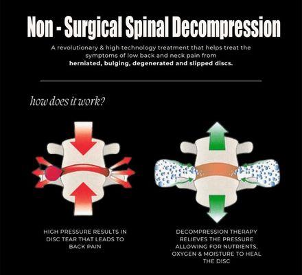 Picture of how Non-surgical Spinal works in Cary, NC