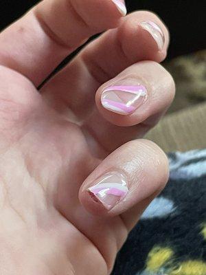 broken nail