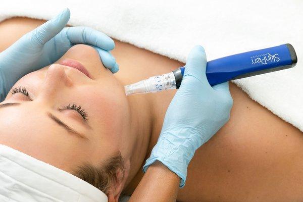 Microneedling with SkinPen is a great way to address texture and get a brighter glow.