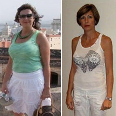 RX Weight Loss Sarasota