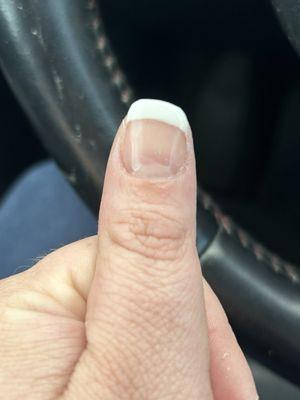 Severely crooked thumb job.