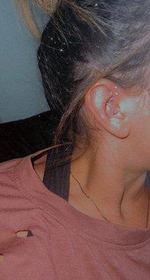 Forward helix and daith