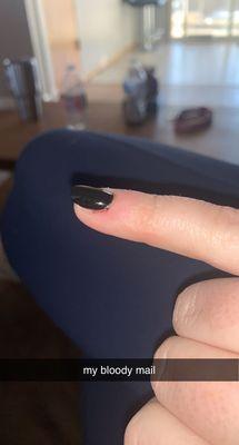 bloody nail from being cut by drill multiple times