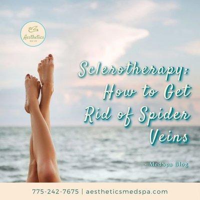 Sclerotherapy @ Aesthetics